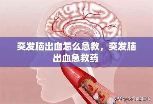 突发脑出血怎么急救,突发脑出血急救药